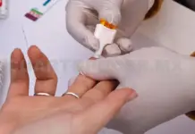 Chiapas remains in fourth place in HIV cases