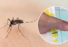 Chikungunya: Quintana Roo registers first case of 2026