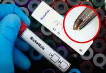 There have been 10 deaths from rickettsia in Baja California so far in 2026; Ensenada accounts for half of them.