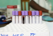 Historic Rise in STDs: Cases of Gonorrhea and Syphilis Reach Unprecedented Levels