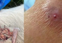 Yucatán Records 28 Cases of Human Myiasis